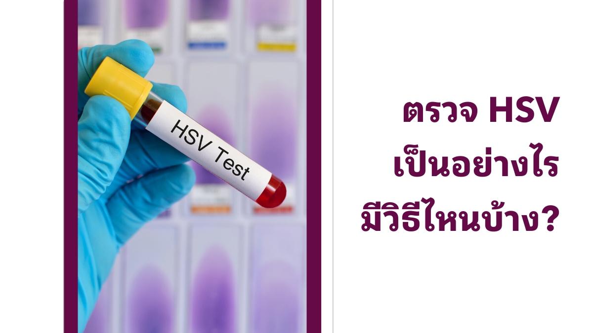 ตรวจ HSV เป็นอย่างไร มีวิธีไหนบ้าง?
