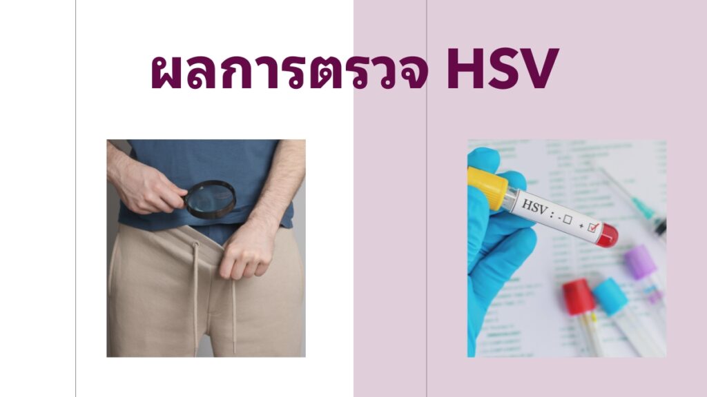 ผลการตรวจ HSV ออกมาแบบไหนได้บ้าง?