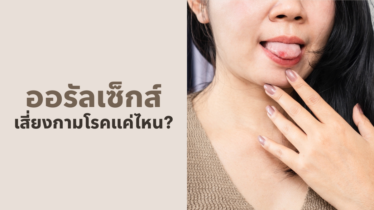 ออรัลเซ็กส์ เสี่ยงกามโรคแค่ไหน