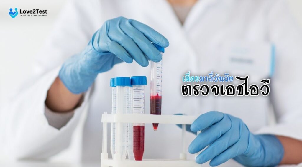 เสี่ยงมากี่วันถึง ตรวจเอชไอวี