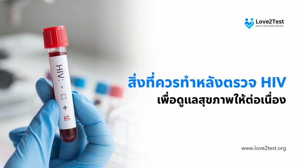 สิ่งที่ควรทำหลังตรวจ HIV เพื่อดูแลสุขภาพให้ต่อเนื่อง