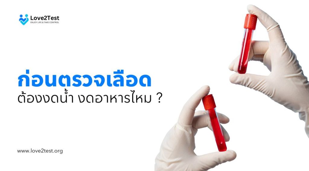 ต้องงดน้ำงดอาหารไหม ก่อนตรวจเลือด HIV