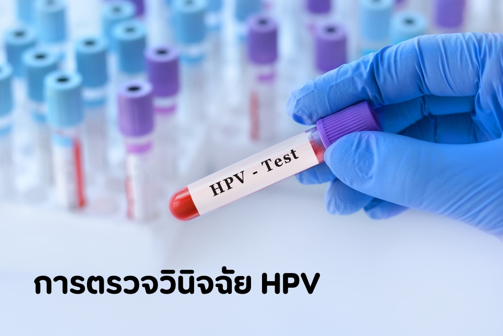 การตรวจวินิจฉัย HPV