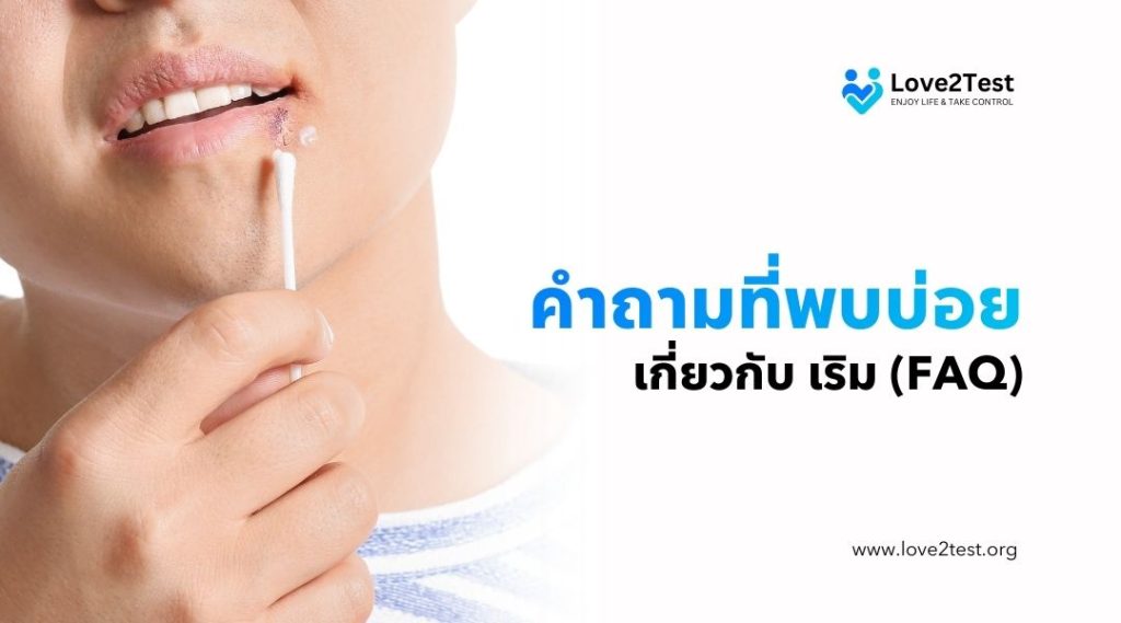 คำถามที่พบบ่อยเกี่ยวกับ เริม (FAQ)