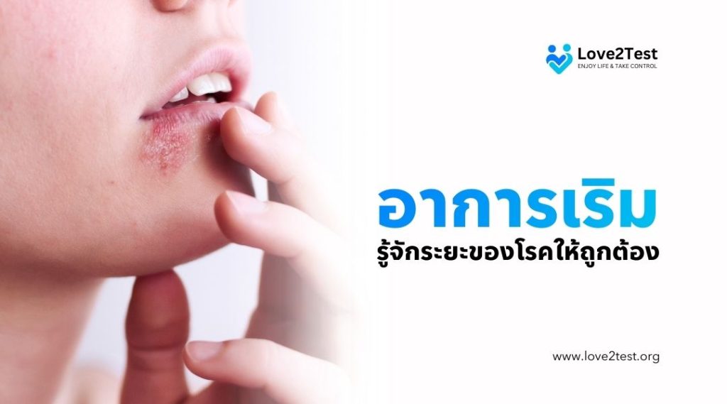 อาการเริม รู้จักระยะของโรคให้ถูกต้อง