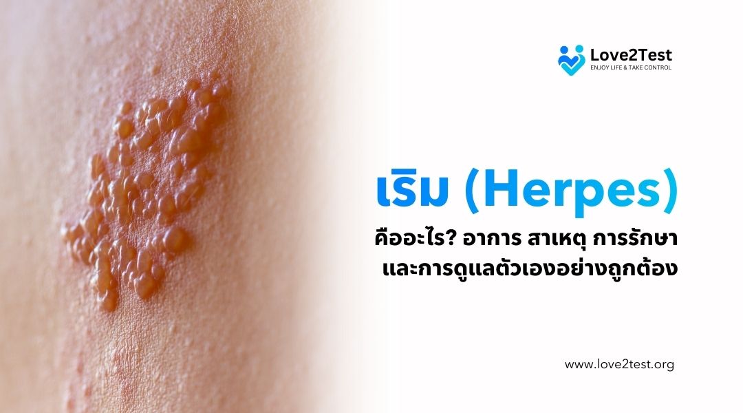 เริม (Herpes) คืออะไร อาการ สาเหตุ การรักษา และการดูแลตัวเองอย่างถูกต้อง